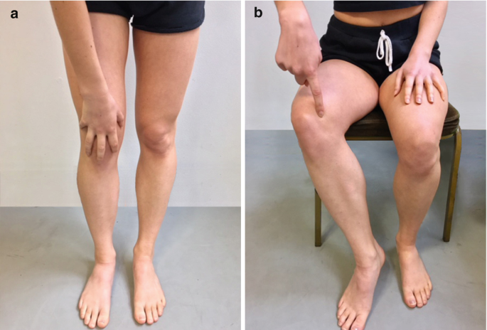 Knee movement illustration